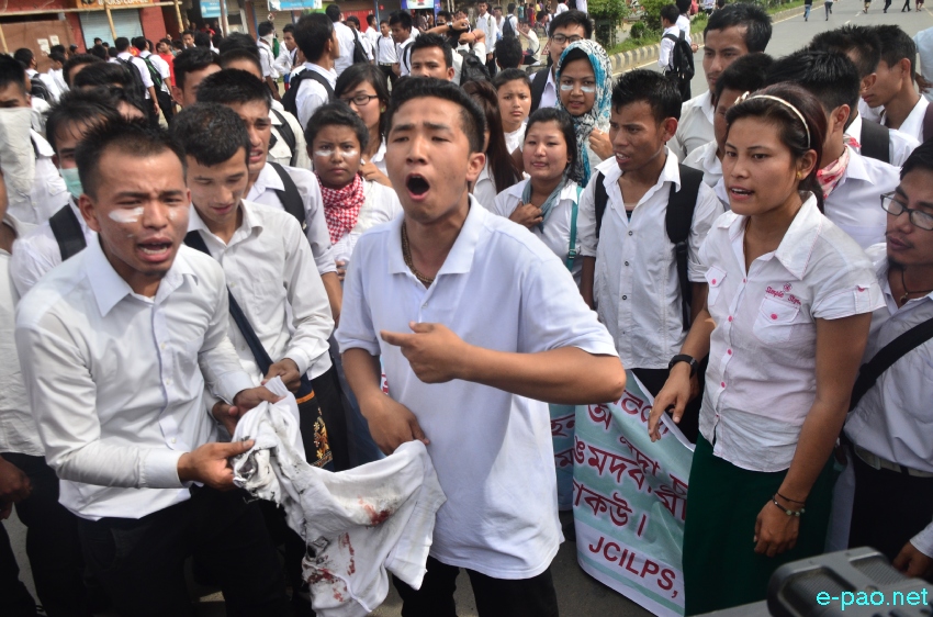 Students  injured during ILPS rally at Singjamei - Yumnam Leikai :: August 06 2014