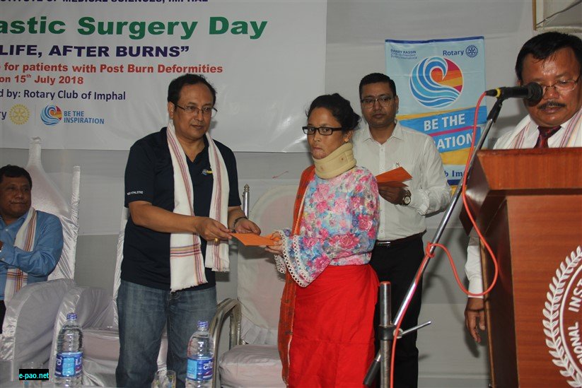 Restore Life After Burns : National Plastic Surgery Day at RIMS, Imphal :: July 15, 2018